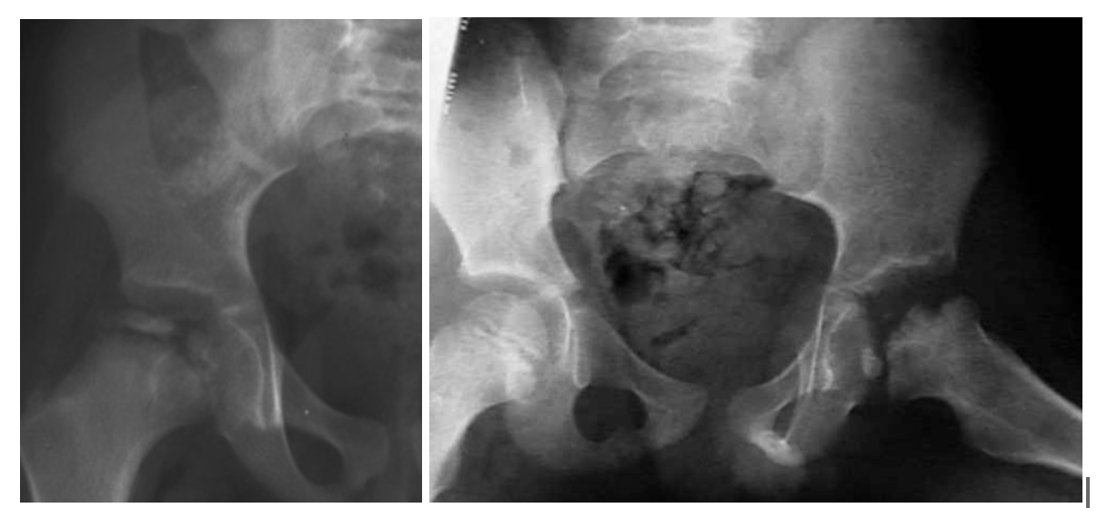 <p>Name this pathology</p>