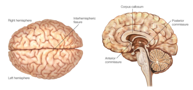 <p>• corpus callosum (consists of bundle of many axons) </p>
<p>• anterior and posterior commissure (also bundles of axons, but smaller)</p>