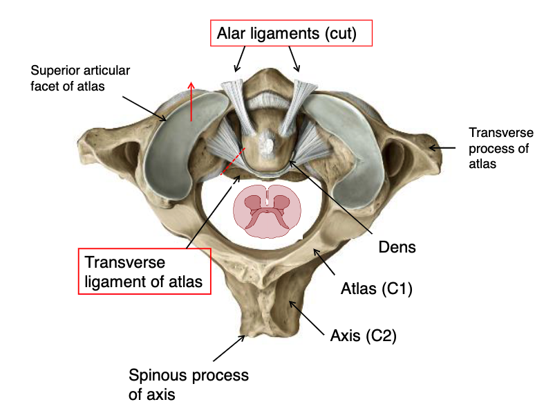 <p>transverse ligament of atlas</p>
