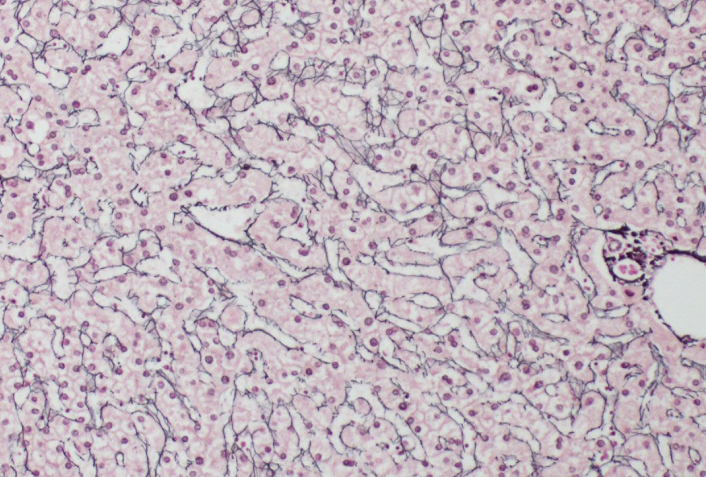 <p>Special stain for reticulin fibers</p>