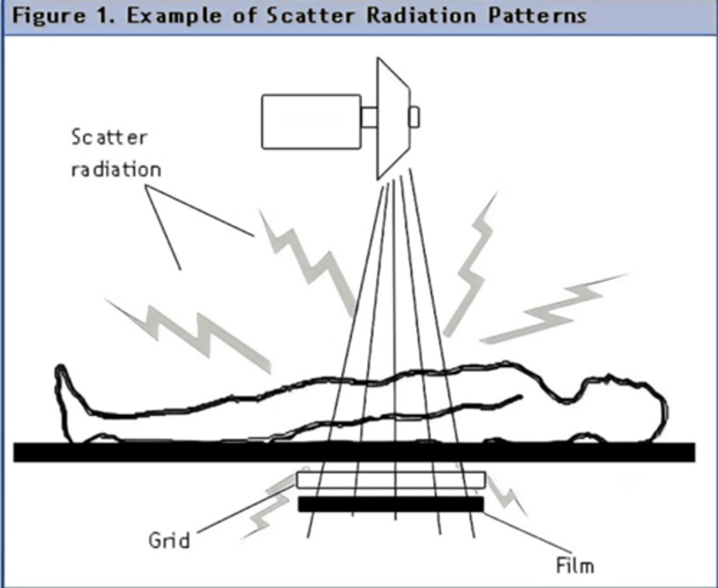 <p>Grid helps to filter out scatter radiation to allow a better image to be recorded!</p>