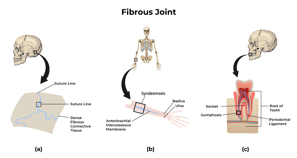 <p>A type of fibrous joint which is made up of a thin layer of desne irregular connective tissue, this type only happens within the bones of the skull</p>