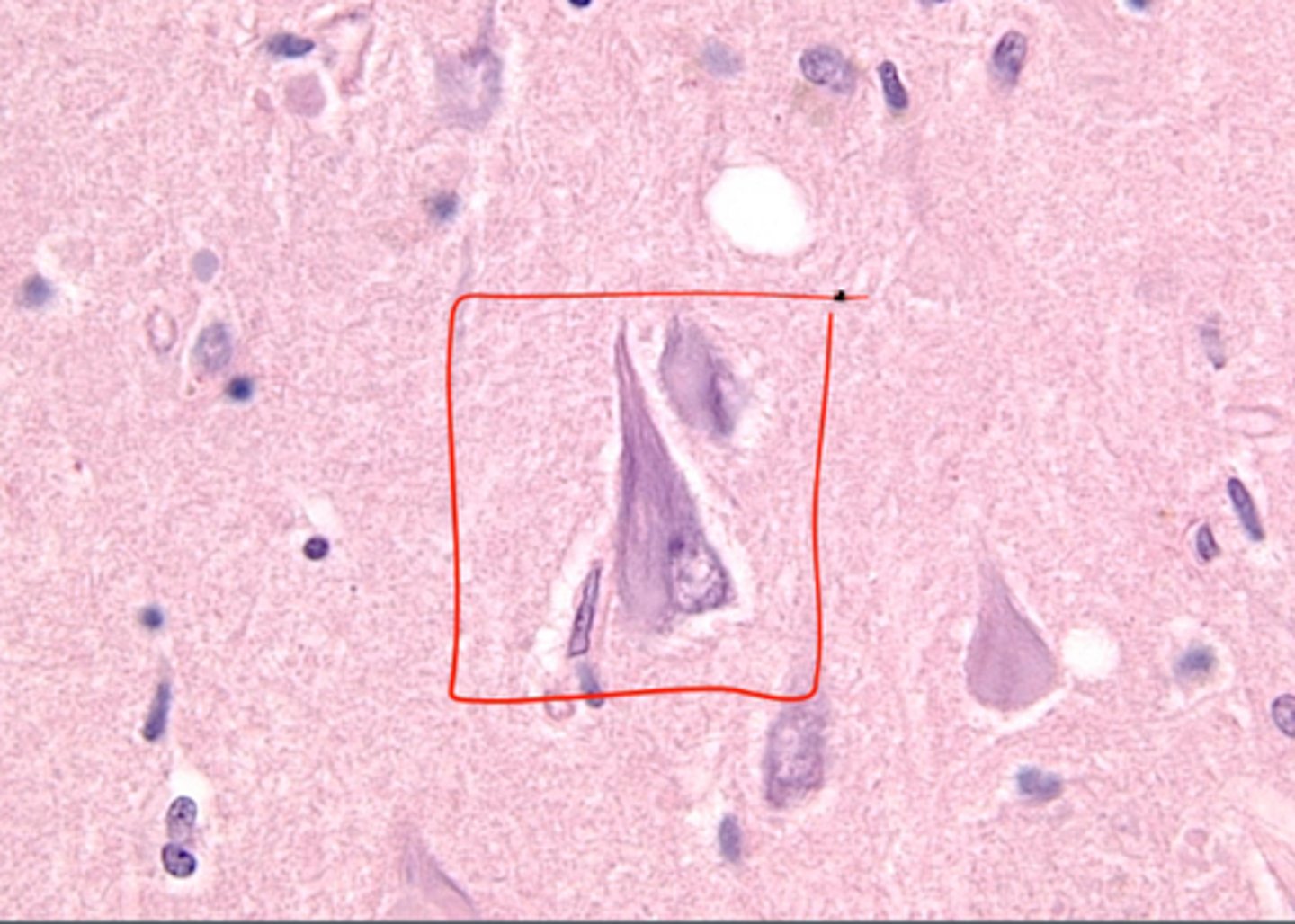 <p>spiral-shaped masses formed when fibers that compose the axon become twisted together</p>