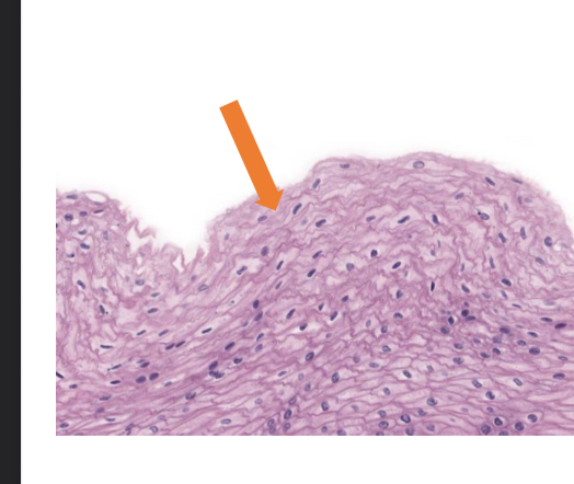 <p>what tissue is this</p>