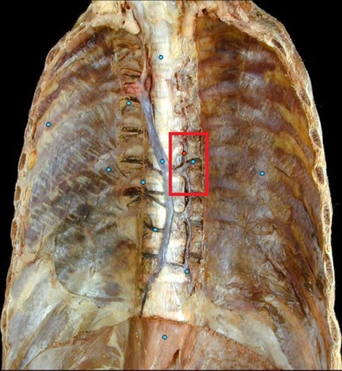<p>-left side</p><p>-superior</p><p>-dumps into left subclavian vein</p><p>-follow to azygous</p>