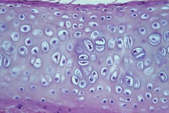 <p>Function: Supports and reinforces structures (like bone), but can bend - eases joint movement</p><p>Location: Ends of long bones, connects ribs to sternum, found at end of nose, in trachea and larynx</p><p>Characteristics: Pairs of lacunae, clear, glassy microscopic appearance. <strong>Covered by perichondrium</strong></p>