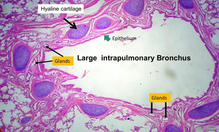 <p>Section in the lung showing <strong>intrapulmonary bronchus</strong></p>