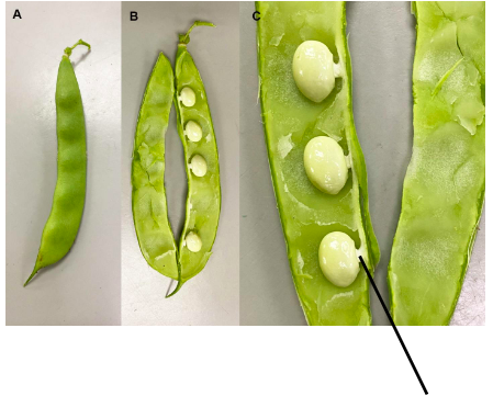 <p>What is depicted here in this developing seed (beans in a pod)</p>