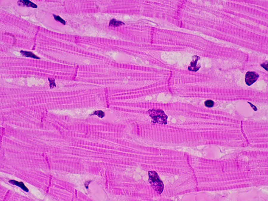 <p>What type of tissue is this?</p>