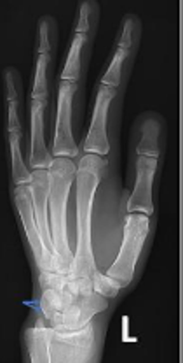 <p>What is the arrow pointing to?</p>