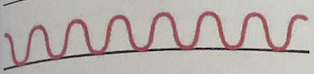 <ul><li><p>More than <strong>24 breaths/minute</strong> and <strong>shallow</strong></p></li><li><p>May be caused by:</p><ul><li><p>Fever</p></li><li><p>Anxiety</p></li><li><p>Exercise</p></li><li><p>Respiratory Insufficiency</p></li><li><p>Alkalosis</p></li><li><p>Pneumonia</p></li><li><p>Pleurisy</p></li></ul></li></ul><p></p>