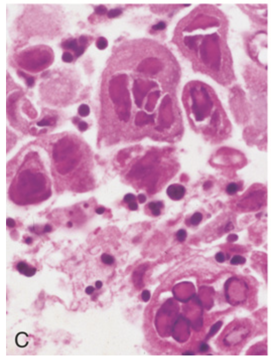 term image