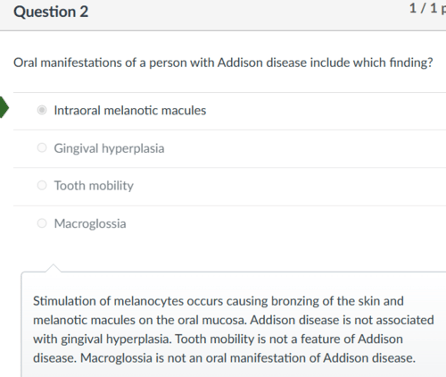 <p>Intraoral melanotic macules</p><p>Stimulation of melanocytes occurs causing bronzing of the skin and melanotic macules on the oral mucosa. Addison disease is not associated with gingival hyperplasia. Tooth mobility is not a feature of Addison disease. Macroglossia is not an oral manifestation of Addison disease.</p>