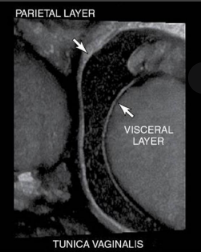 <p>what are the layers of tunica vaginalis</p>