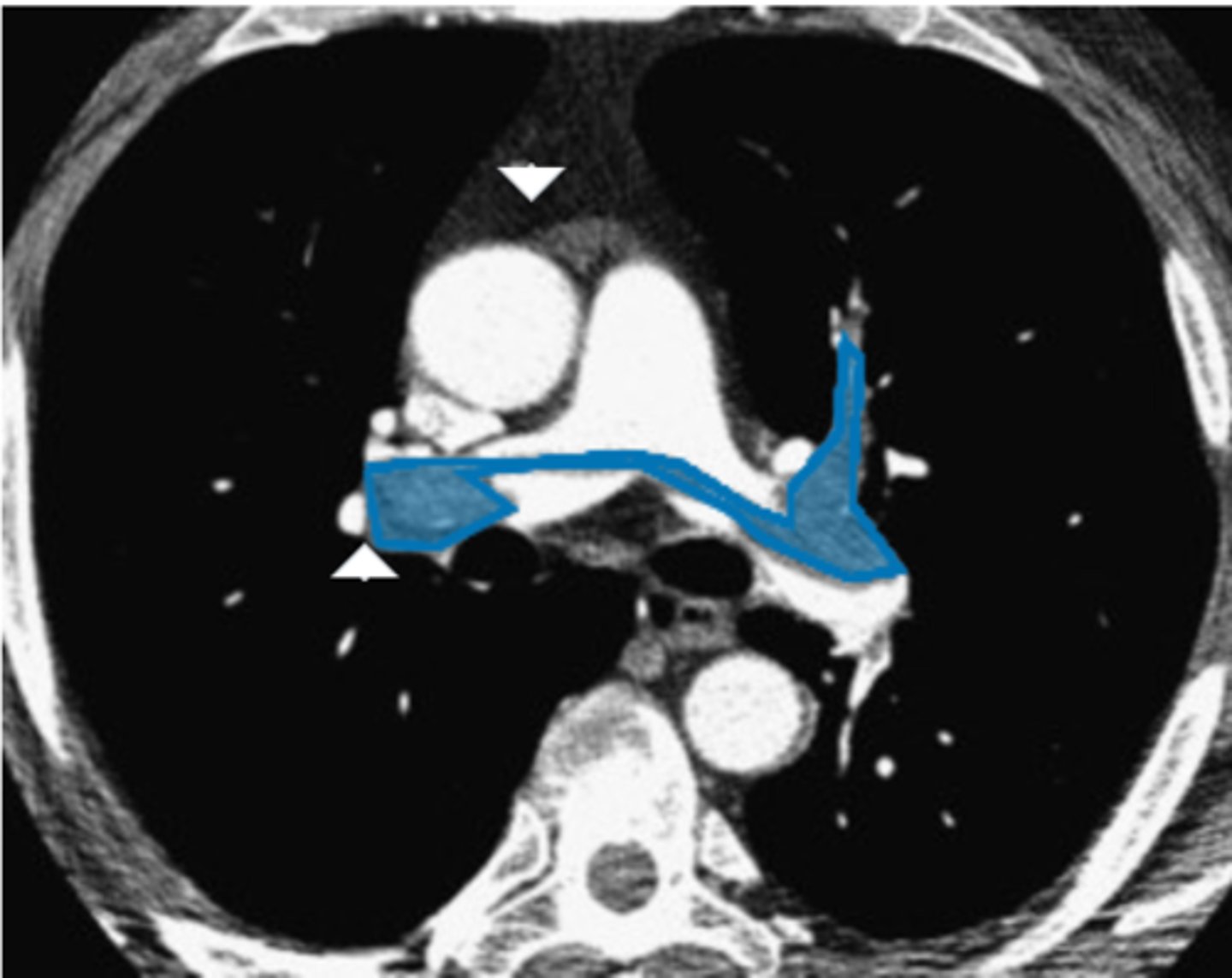 <p>Label pathology in image below</p>