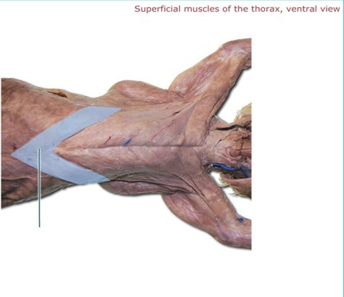 <p>-no muscle corresponding to this in man</p><p>-originates- most posterior part of sternum (xiphoid process)</p><p>-inserts- humerus with pectoralis major and latissimus dorsi</p><p>-v shaped</p><p>-function: works with the pectoralis minor to draw the fore limb towards the midline</p>