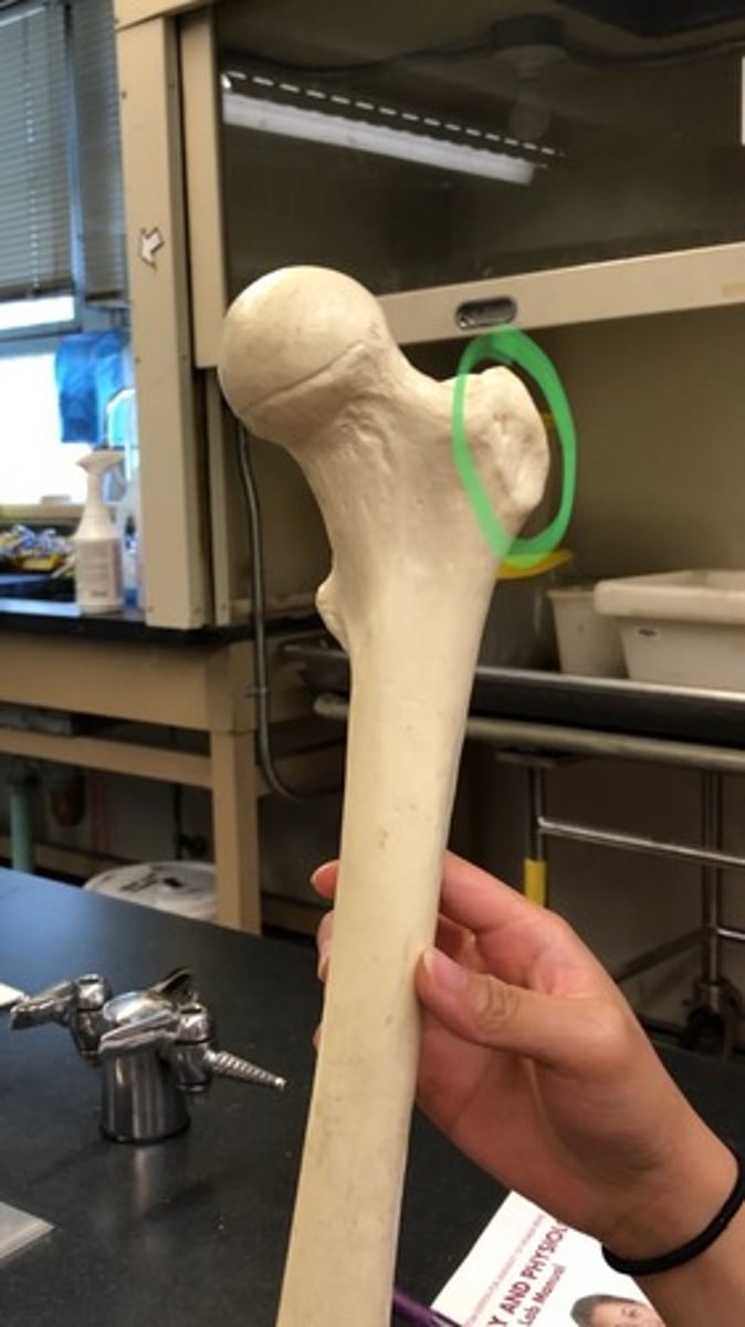 <p>lateral; side of head</p>