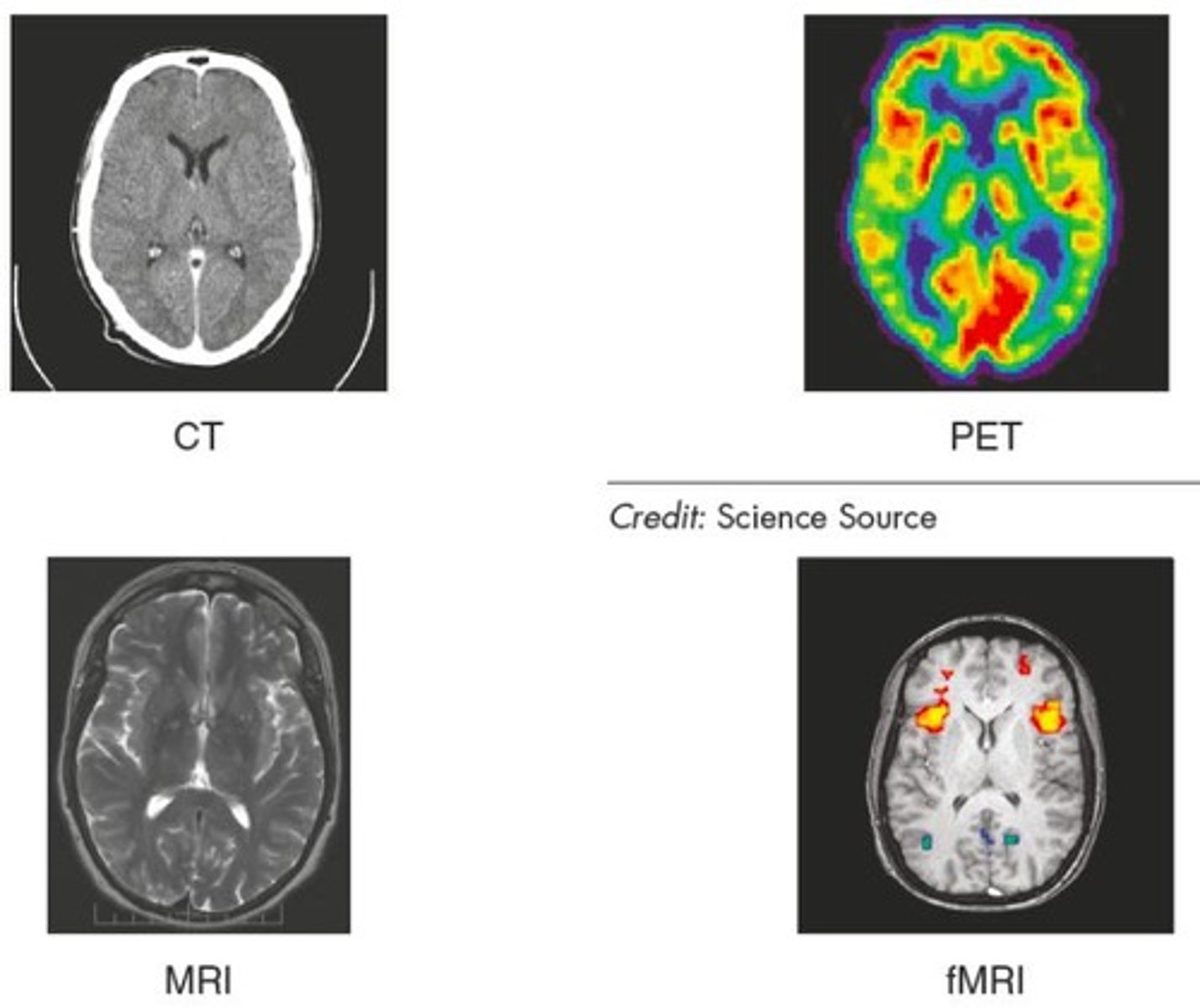 <p>To study the human brain using minimally invasive methods.</p>