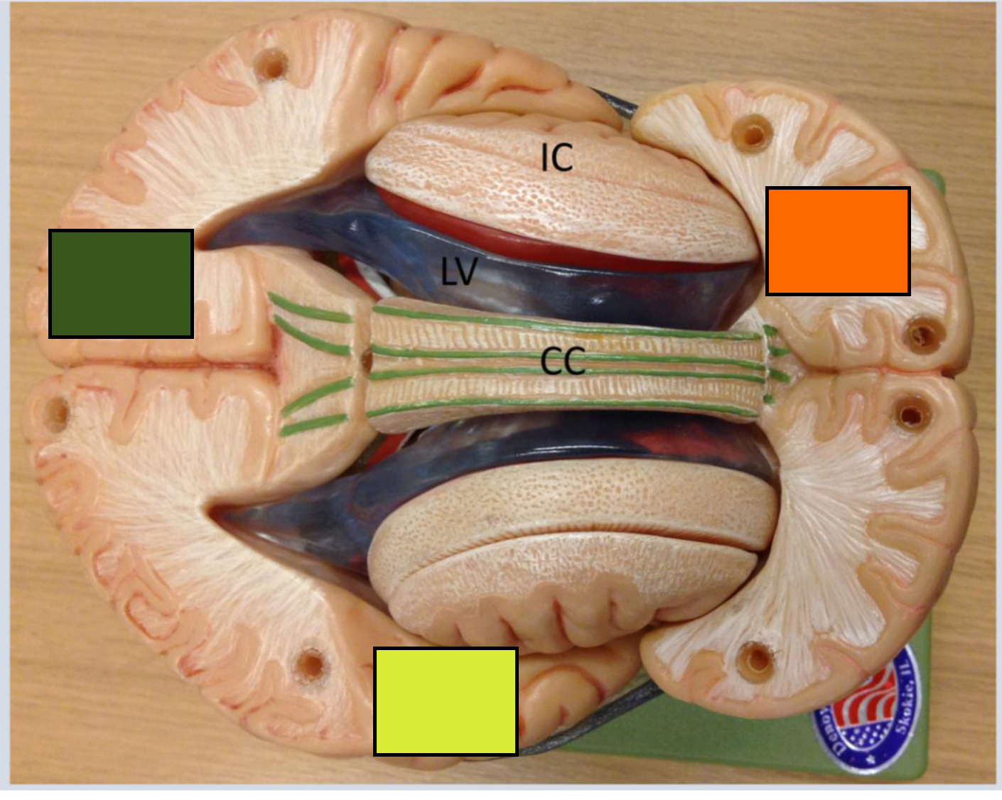 <p>Occipital cortex</p>