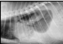 <p><span>Chylothorax</span></p>