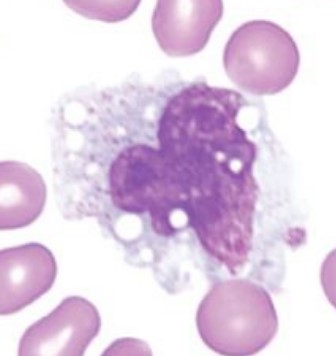 <p><span style="font-family: "Times New Roman", serif">Largest WBC. Kidney-shaped nucleus; differentiate into macrophages in tissues and help in phagocytosis and antigen presentation.</span></p>