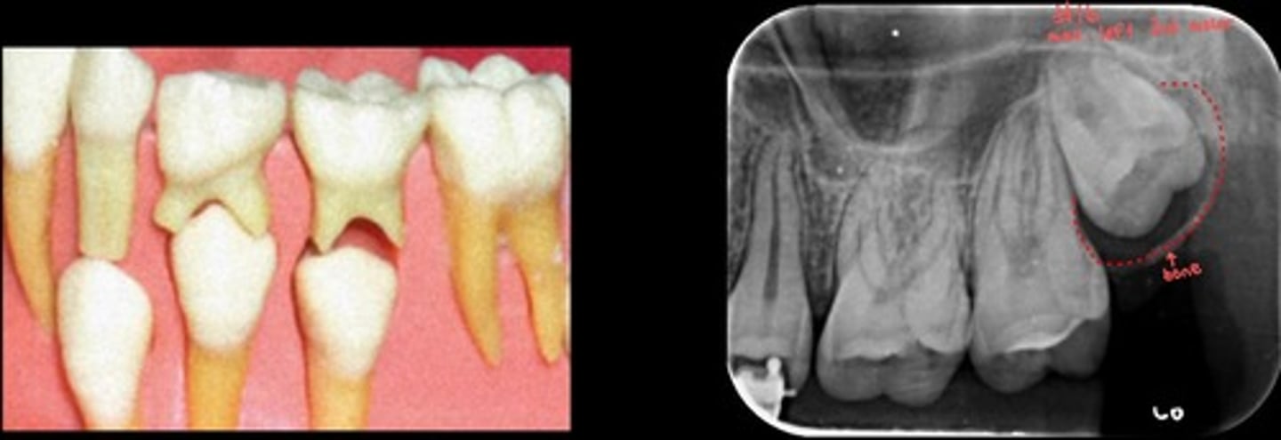 <p>What is the red dotted line representing?</p>