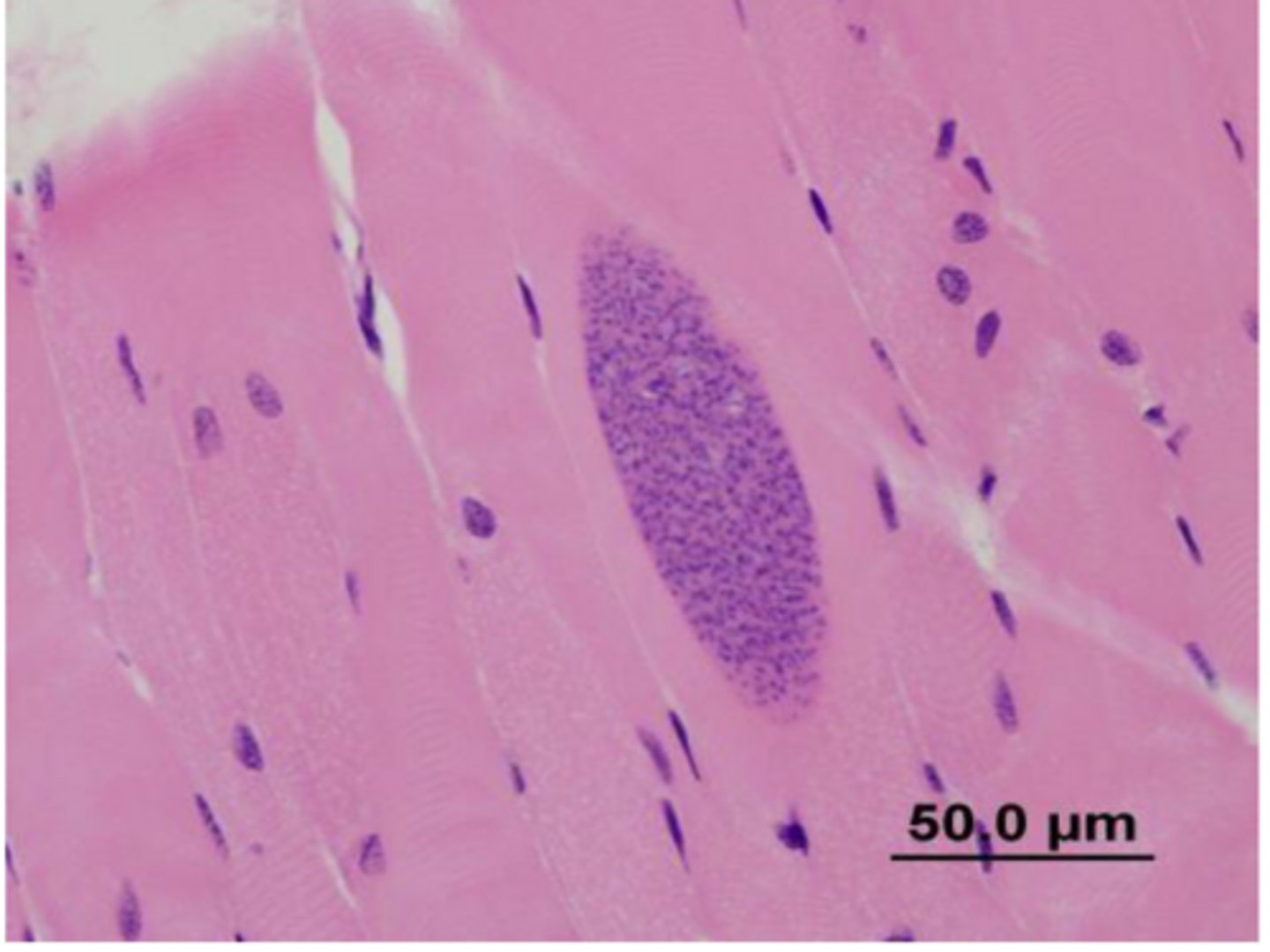 <p>In most species Sarcocystis will be an ___ finding?</p>
