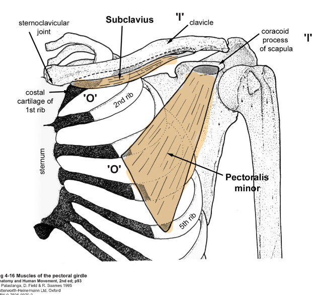 <p>O= ribs 3→5 (anterior-lateral side)</p><p>I= coracoid process</p><p>A=depresses scapula. (Helps with breathing)</p><p>IN=medial pectoral nerve</p><p>(Medial pec nerve must pass through pec minor to reach pec major)</p>
