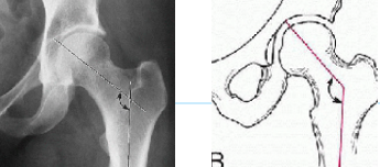 <p>Q what is the name of this measurement? and what is the average + range?</p>