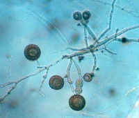 <p>Which protist is this?</p>