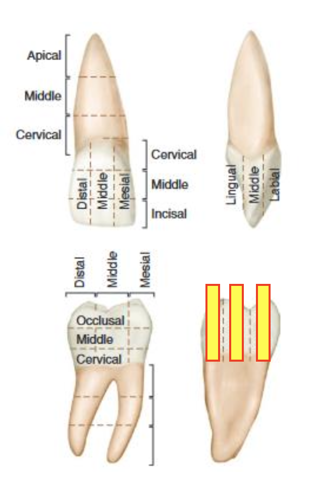 term image