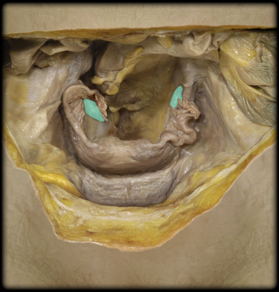 <p>What structure is shown?</p>