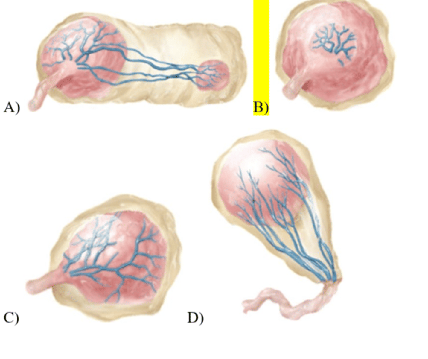 <p>39) A patient's placenta it is identified as having a double fold of chorion and amnion that formed a ring around the umbilical cord on the fetal side of the placenta. What should the nurse expect when examining this placenta?</p>