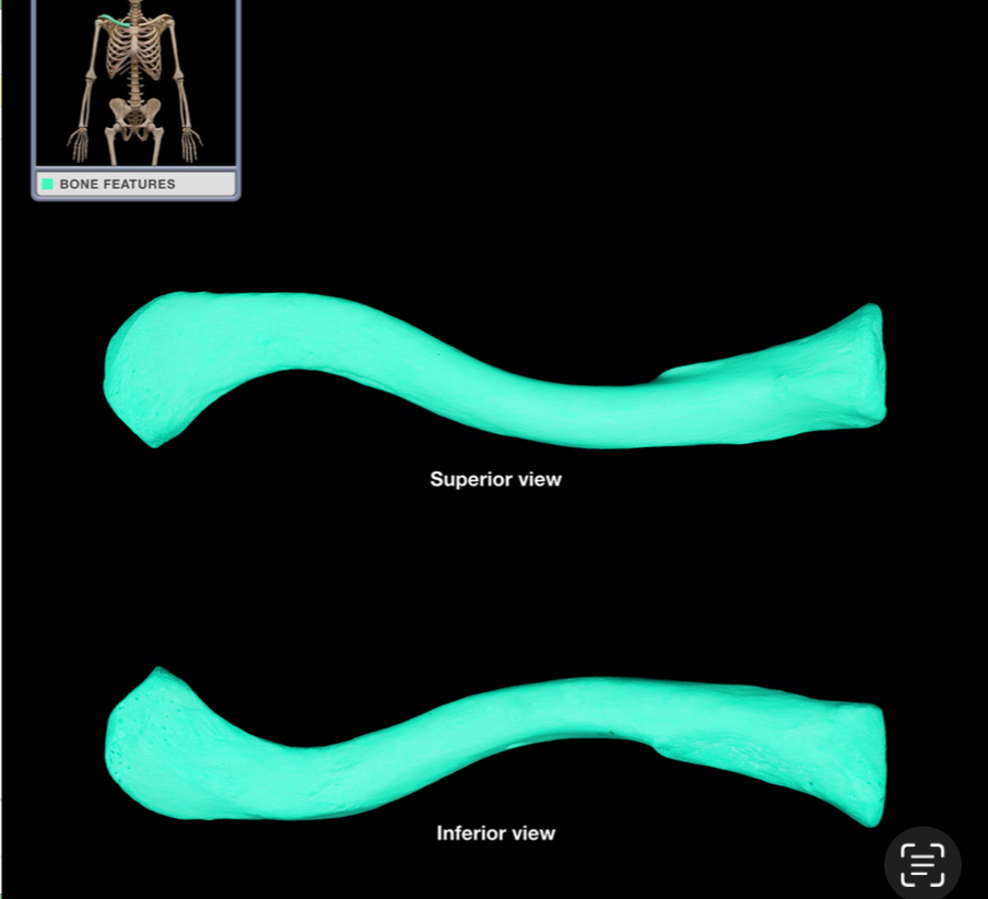 <p>What bone is shown? </p>