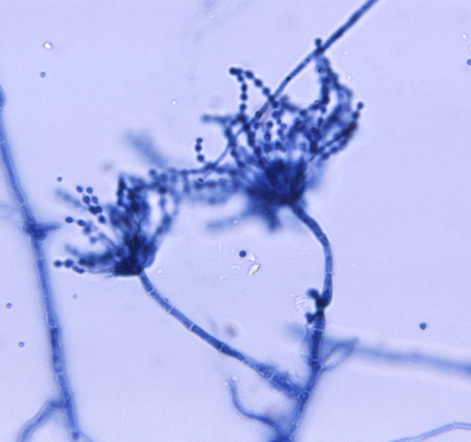 <p>What are these? Function?</p>