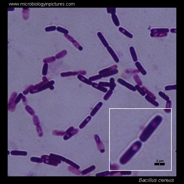 Bacillus cereus