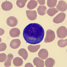 <p>What is this leukocyte?</p>