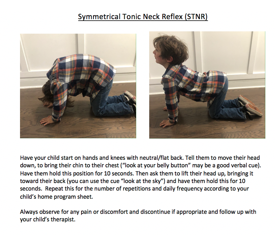 <p>STNR </p>