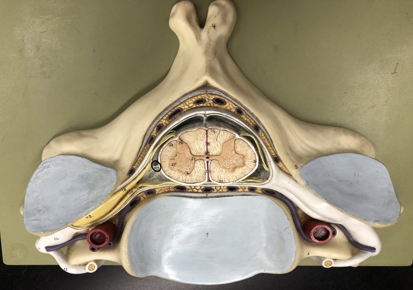 <p>what is this part of the vertebrae (of the spinal cord?)</p>