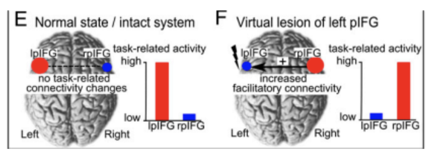 <p><u>functional modular plasticity=</u> what's happening at the network level, as opposed to the individual/cellular level or what’s happening at individual synapses</p><ul><li><p><strong><u>allows for the ***shifting of operations from ***one region of the brain ***to another region</u></strong> - specific <strong><u>process is ***carried out by the ***homologous region in the ***opposite hemisphere</u></strong></p></li><li><p>thought to <strong><u>happen most often during the ***early critical stages of development and in ***response to injury/disease process</u></strong></p></li></ul><p></p>