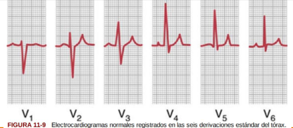 <p>V1 , V2 , V3 , V4 , V5 y V6.</p><p>En las derivaciones V1 y V2 los registros QRS del corazón normal son principalmente negativos porque, el electrodo del tórax de estas derivaciones está más cerca de la base del corazón que de la punta.</p><p>Por el contrario, los complejos QRS de las derivaciones V4 , V5 y V6 son principalmente positivos porque el electrodo del tórax de estas derivaciones está más cerca de la punta cardíaca.</p>