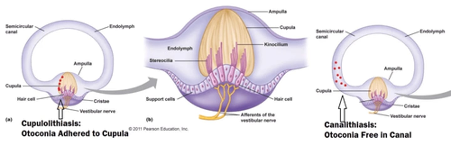 <p>episodes lasting < 1 min</p><p>- most common</p>
