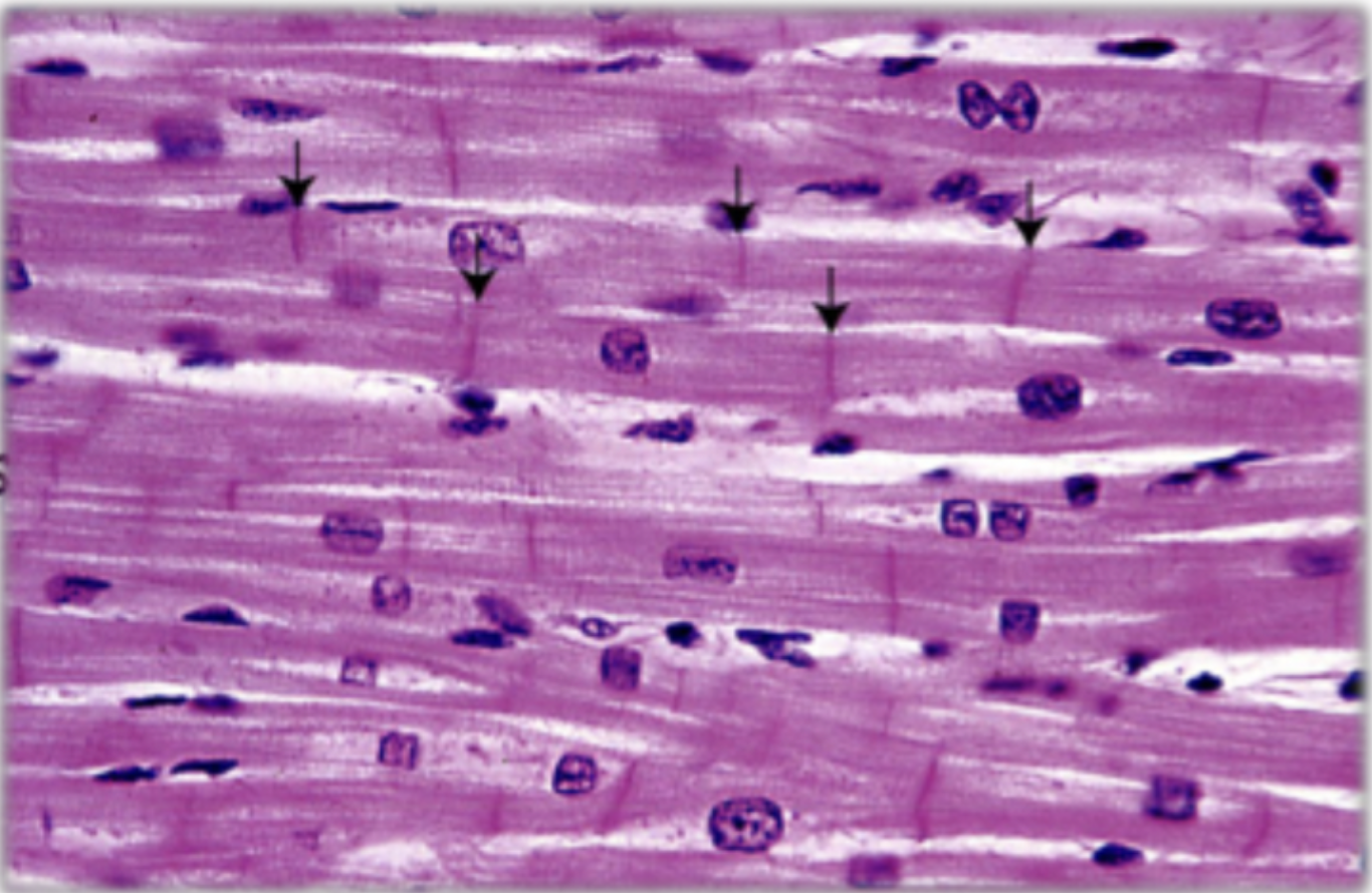 <p>involuntary, striated, one or two central nuclei, branched fibres, intercalated discs, found in the heart, very limited regeneration, more mitochondria than skeletal</p>