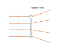 <p>Myopia, can be corrected with a diverging/concave corrective lens (-). </p>