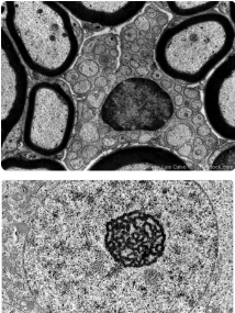<ul><li><p>Best for</p><ul><li><p>observing the internal ultrastructure of cells, organelles , and biomolecules at very high resolution (nm)</p></li></ul></li><li><p>Ex. determining the presence of specific organelle structures in a diseased cell</p></li><li><p>Why?</p><ul><li><p>provides extremely high magnification and resolution, allowing detailed visualization of cellular interiors</p></li></ul></li></ul><p></p>