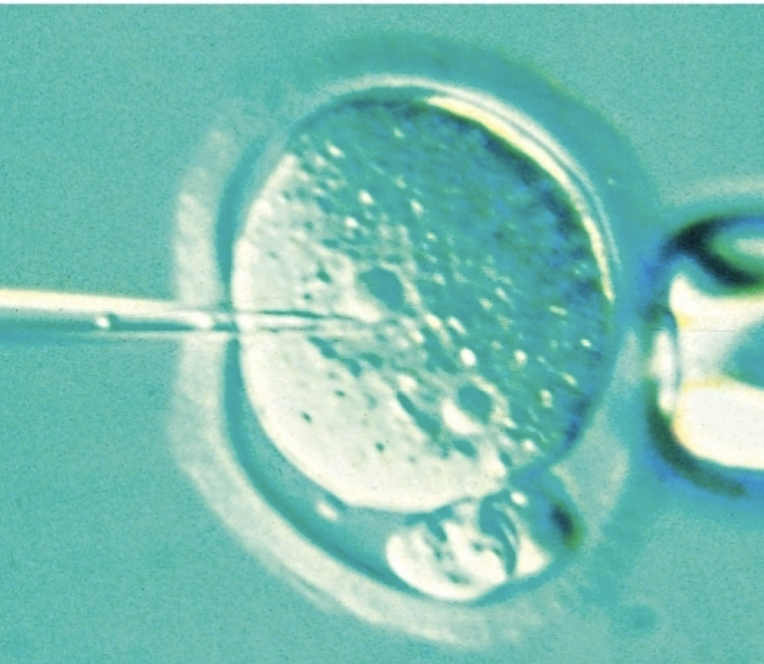 <ul><li><p>injects DNA directly into a cell’s plasma mem </p></li><li><p><strong>glass micropipette under microscope</strong></p></li></ul><p></p>