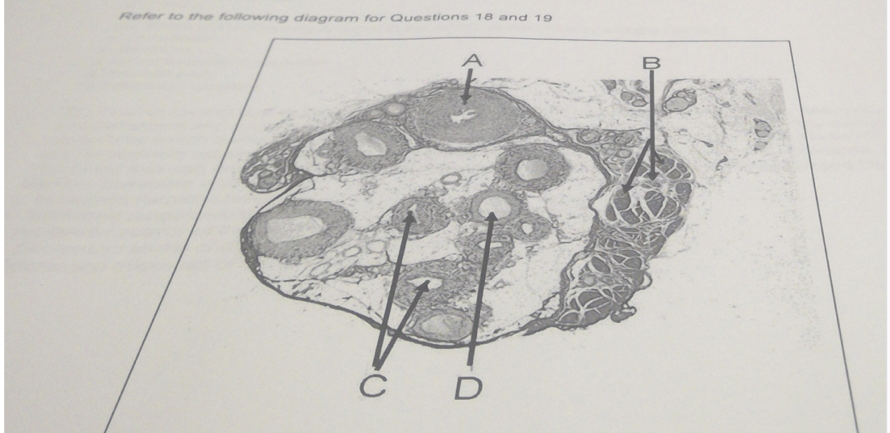 19) Which structure shown in the micrograph is required for propulsion of semen thourgh the male reproductive tract?