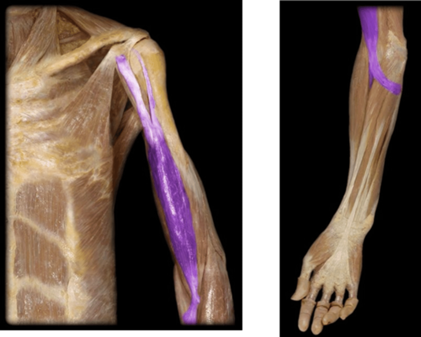 <p>What is the name of this muscle, highlighted in purple?</p>