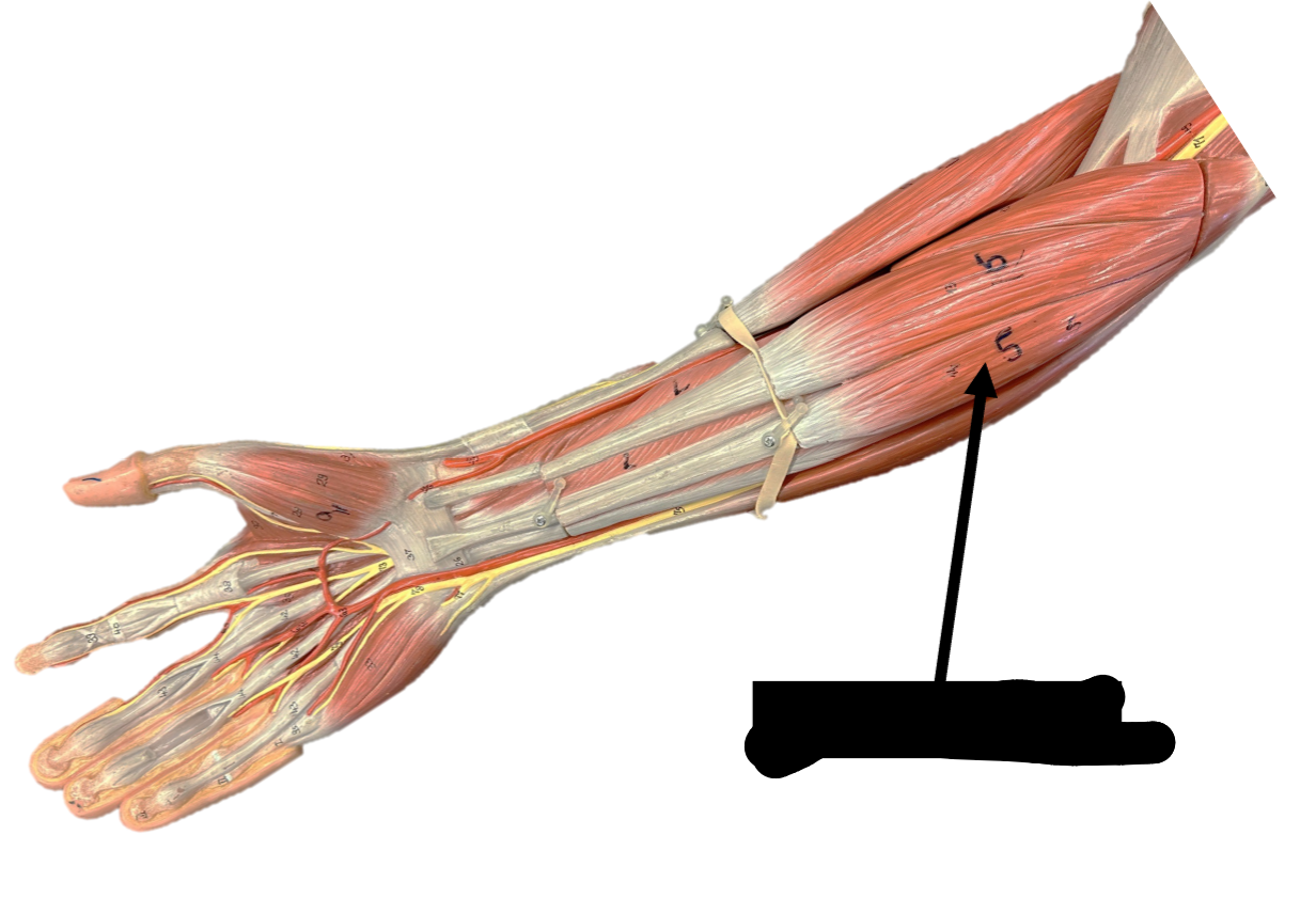 <p>Origin: medial epicondyle of humerus</p><p>Insertion: palmar aponeurosis</p><p>Function: flexes wrist</p>