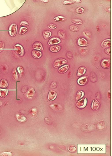 <p>What type of cartilage?</p>